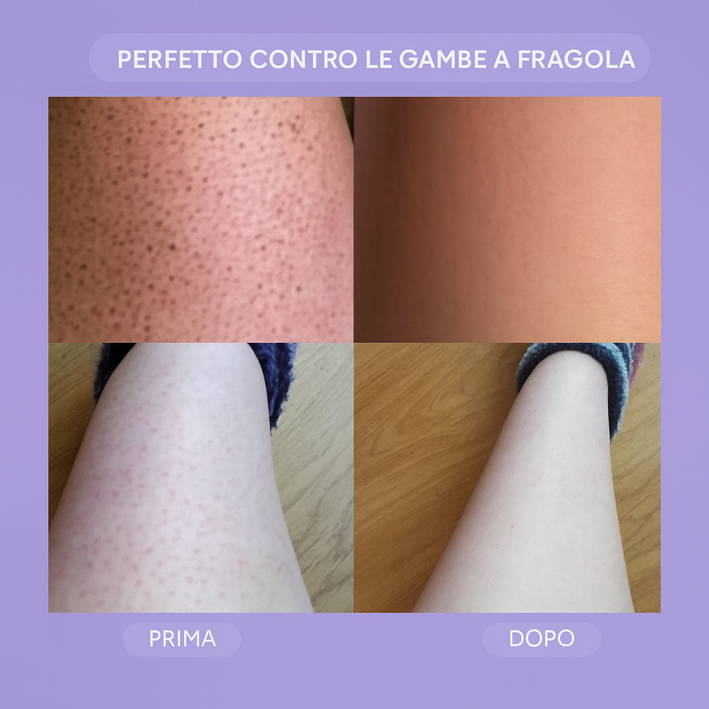 Depilatore Rosmira