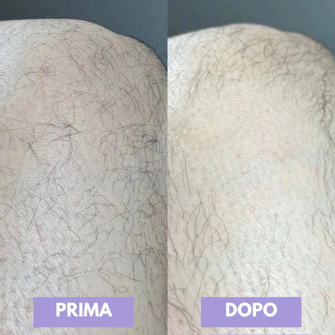 Depilatore Rosmira